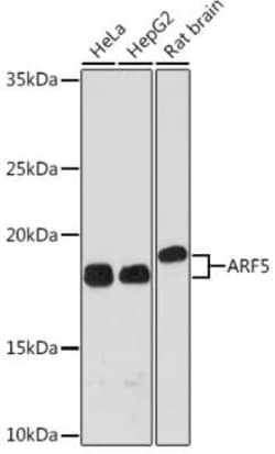 ARF5 Rabbit anti-Human, Mouse, Rat, Clone: 0U0D2, Novus Biologicals 100 &mu;g | Buy Online | Novus Biologicals | Fisher Scientific