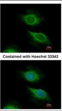 ARF5 Antibody, Novus Biologicals 100 &mu;L | Buy Online | Novus Biologicals | Fisher Scientific