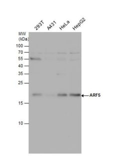 ARF5 Antibody, Novus Biologicals 100 &mu;L | Buy Online | Novus Biologicals | Fisher Scientific