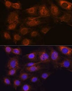 ARF6 Rabbit anti-Human, Mouse, Rat, Clone: 9E7T9, Novus Biologicals 20