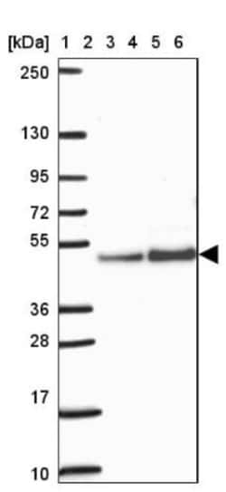 ARFGAP1 Antibody, Novus Biologicals:Antibodies:Primary Antibodies