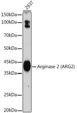 ARG2 Rabbit anti-Human, Clone: 1Y5U3, Novus Biologicals 100 &mu;g | Buy Online | Novus Biologicals | Fisher Scientific