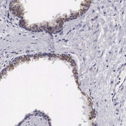 HSD17B4 Antibody, Novus Biologicals:Antibodies:Primary Antibodies