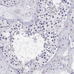 HSD17B4 Antibody, Novus Biologicals:Antibodies:Primary Antibodies