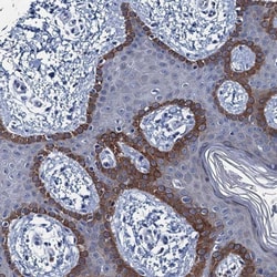 ARHGAP11A Antibody, Novus Biologicals:Antibodies:Primary Antibodies