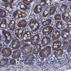 ARHGAP11A Antibody, Novus Biologicals:Antibodies:Primary Antibodies