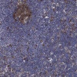 ARHGAP11A Rabbit anti-Human, Polyclonal, Novus Biologicals 100 &mu;g | Buy Online | Novus Biologicals | Fisher Scientific