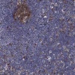 ARHGAP11A Rabbit anti-Human, Polyclonal, Novus Biologicals 100 &mu;g | Buy Online | Novus Biologicals | Fisher Scientific