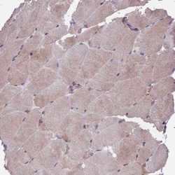 ARHGAP12 Antibody, Novus Biologicals:Antibodies:Primary Antibodies