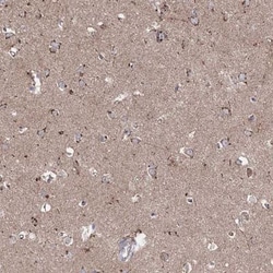 ARHGAP20 Antibody, Novus Biologicals:Antibodies:Primary Antibodies