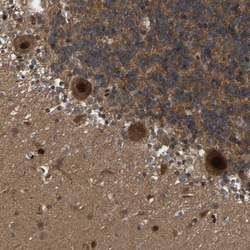 ARHGAP23 Antibody, Novus Biologicals 0.1mL; Unlabeled:Antibodies, Polyclonal
