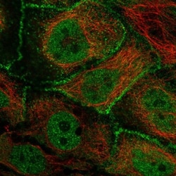 ARHGAP28 Antibody, Novus Biologicals 25 &mu;L; Unlabeled:Antibodies, Polyclonal