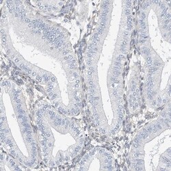 ARHGAP28 Antibody, Novus Biologicals 25 &mu;L; Unlabeled:Antibodies, Polyclonal