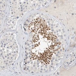 ARHGAP28 Antibody, Novus Biologicals 25 &mu;L; Unlabeled:Antibodies, Polyclonal