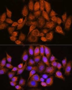 ARHGAP30 Rabbit anti-Human, Mouse, Polyclonal, Novus Biologicals:Antibodies:Primary