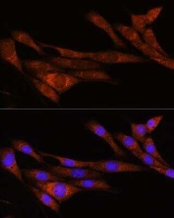 ARHGAP30 Rabbit anti-Human, Mouse, Polyclonal, Novus Biologicals:Antibodies:Primary