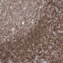 ARHGAP30 Antibody, Novus Biologicals 25 &mu;L; Unlabeled:Antibodies, Polyclonal