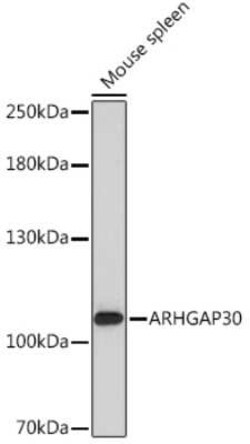ARHGAP30 Rabbit anti-Human, Mouse, Polyclonal, Novus Biologicals:Antibodies:Primary