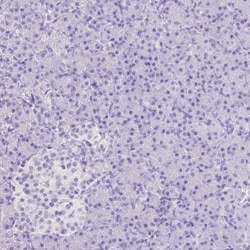 ARHGAP36 Antibody, Novus Biologicals 25 &mu;L, Unlabeled:Antibodies, Polyclonal