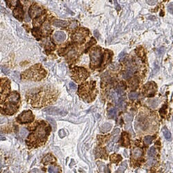ARHGAP36 Antibody, Novus Biologicals 25 &mu;L, Unlabeled:Antibodies, Polyclonal