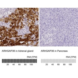 ARHGAP36 Antibody, Novus Biologicals 25 &mu;L, Unlabeled:Antibodies, Polyclonal