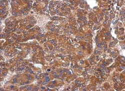 ARHGAP36 Antibody, Novus Biologicals 0.1mL; Unlabeled:Antibodies, Polyclonal