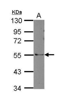 ARHGAP36 Antibody, Novus Biologicals 0.1mL; Unlabeled:Antibodies, Polyclonal