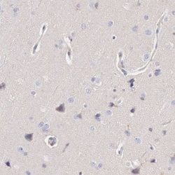 ARHGAP4 Antibody, Novus Biologicals:Antibodies:Primary Antibodies