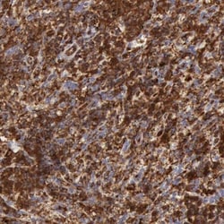 ARHGAP4 Antibody, Novus Biologicals:Antibodies:Primary Antibodies