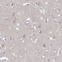 ARHGAP44 Antibody, Novus Biologicals:Antibodies:Primary Antibodies