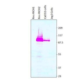 ARHGAP44 Antibody, Novus Biologicals 100 &mu;g | Buy Online | Novus Biologicals | Fisher Scientific
