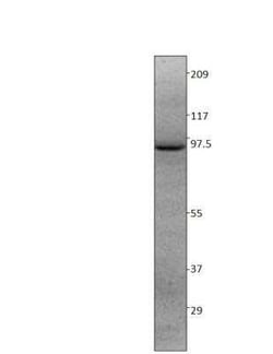 ARHGAP44 Antibody, Novus Biologicals 100 &mu;g | Buy Online | Novus Biologicals | Fisher Scientific