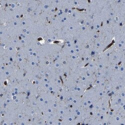 ARHGEF1 Antibody, Novus Biologicals:Antibodies:Primary Antibodies