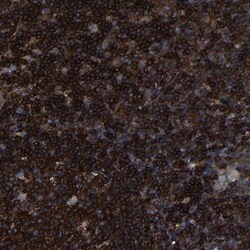 ARHGEF1 Antibody, Novus Biologicals:Antibodies:Primary Antibodies