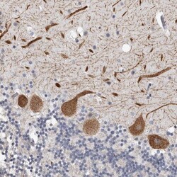 ARHGEF10 Antibody, Novus Biologicals 0.1mL; Unlabeled:Antibodies, Polyclonal