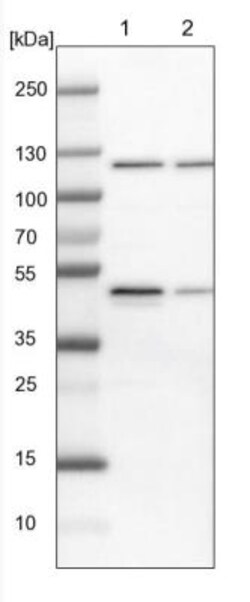 ARHGEF10 Antibody, Novus Biologicals 0.1mL; Unlabeled:Antibodies, Polyclonal