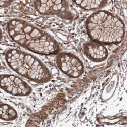 ARHGEF11 Antibody, Novus Biologicals:Antibodies:Primary Antibodies