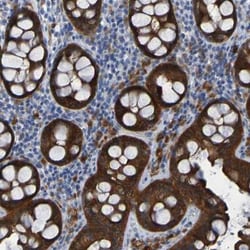 ARHGEF16 Antibody, Novus Biologicals:Antibodies:Primary Antibodies