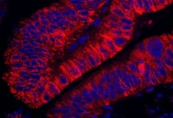 ARHGEF5 Antibody, Novus Biologicals 0.1mL; Unlabeled:Antibodies, Polyclonal