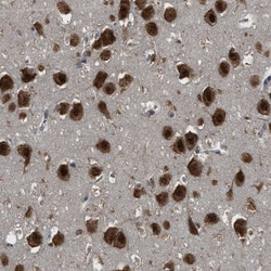 ARHGEF5 Antibody, Novus Biologicals:Antibodies:Primary Antibodies