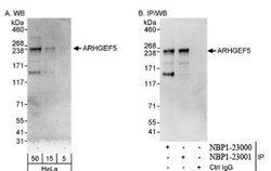 ARHGEF5 Antibody, Novus Biologicals 0.1mL; Unlabeled:Antibodies, Polyclonal