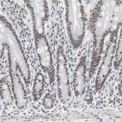 ARID1A Antibody, Novus Biologicals 25 &mu;L; Unlabeled:Antibodies, Polyclonal