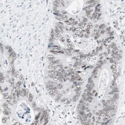 ARID1A Antibody, Novus Biologicals 25 &mu;L; Unlabeled:Antibodies, Polyclonal