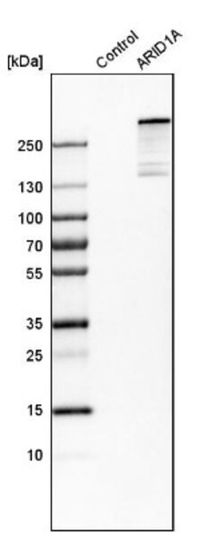 ARID1A Antibody, Novus Biologicals 25 &mu;L; Unlabeled:Antibodies, Polyclonal