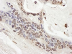 ARID1B Antibody, Novus Biologicals 0.1mL; Unlabeled:Antibodies, Polyclonal
