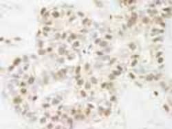 ARID1B Antibody, Novus Biologicals 100 &mu;L | Buy Online | Novus Biologicals | Fisher Scientific