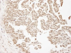 ARID1B Antibody, Novus Biologicals 100 &mu;L | Buy Online | Novus Biologicals | Fisher Scientific