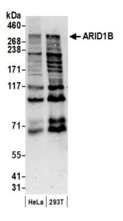 ARID1B Antibody, Novus Biologicals 0.1mL; Unlabeled:Antibodies, Polyclonal