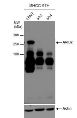 ARID2 Antibody (7311), Novus Biologicals 0.1mL; Unlabeled:Antibodies, Monoclonal