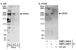 ARID2 Antibody, Novus Biologicals 0.1mg; Unlabeled:Antibodies, Polyclonal